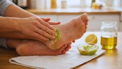 Heal Dry Cracked Heels Faster at Home Using Simple Kitchen Ingredients That Actually Work