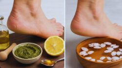 Fast Ways to Heal Dry Cracked Heels at Home Using Safe and Effective Kitchen Ingredients